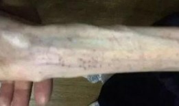 嘉兴离婚吃瓜事件视频