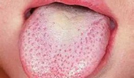 舌头吃瓜的视频