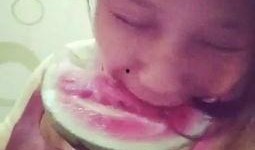 给吃瓜男孩点痣视频